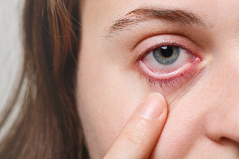 Learn How To Avoid Contact Lenses Risks.
