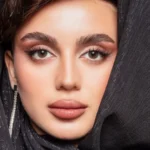 إيليت أفوكادو